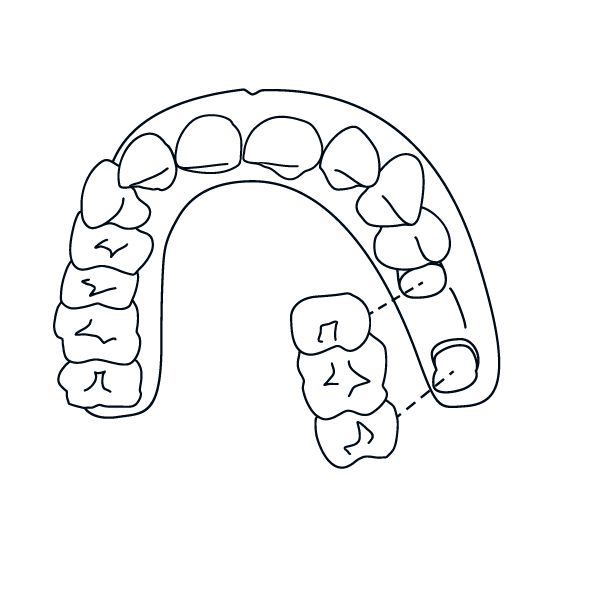 Leistungen-Kiefer-Zahnersatz